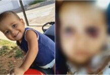Bebê morre com sinais de múltiplas fraturas e laceração no fígado devido a agressões