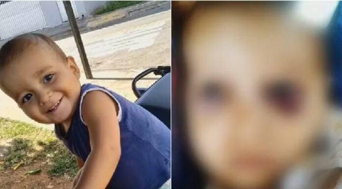 Bebê morre com sinais de múltiplas fraturas e laceração no fígado devido a agressões