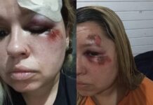 Fio solto enrosca no pneu traseiro e causa violenta queda de ciclista em Piçarras