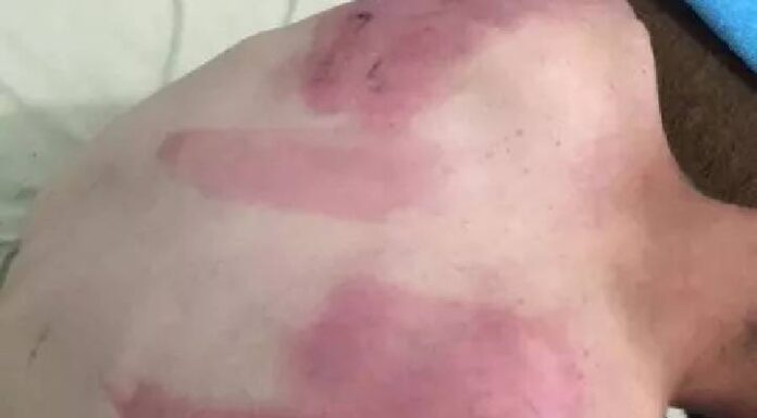 Guardas municipais são condenados por tortura de homem com deficiência em Balneário Camboriú