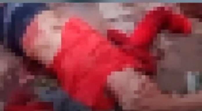 Homem tem braços amputados após ser atacado por pitbulls