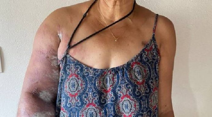 Moradora de Armação precisa de ajuda para tratamento de câncer