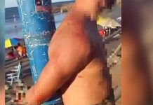 Homem é espancado e amarrado em poste depois de correr atrás de criança em praia de SC