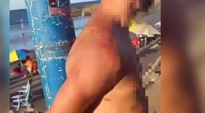Homem é espancado e amarrado em poste depois de correr atrás de criança em praia de SC