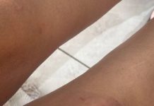 No Dia da Mulher, grávida de 5 meses apanha do marido em Itajaí