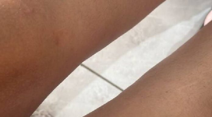No Dia da Mulher, grávida de 5 meses apanha do marido em Itajaí