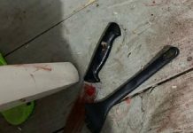 Mulher é atacada pelo ex com garfadas e facadas em Itajaí