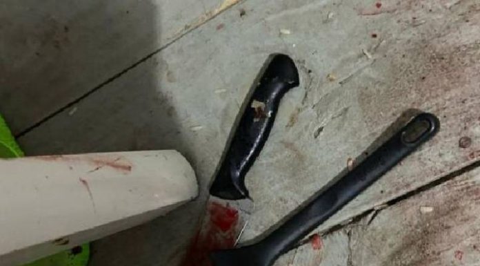 Mulher é atacada pelo ex com garfadas e facadas em Itajaí