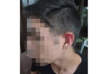 Adolescente leva mordida na orelha durante assalto em Piçarras