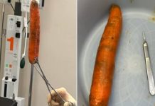 Homem vai parar na emergência com “cenourão” no ânus