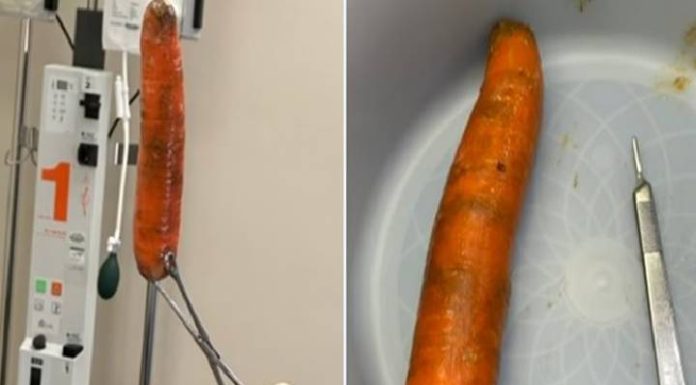 Homem vai parar na emergência com “cenourão” no ânus