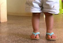 Bebê cai de trocador, sofre fratura grave na cabeça e creche omite socorro em SC