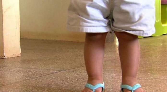 Bebê cai de trocador, sofre fratura grave na cabeça e creche omite socorro em SC