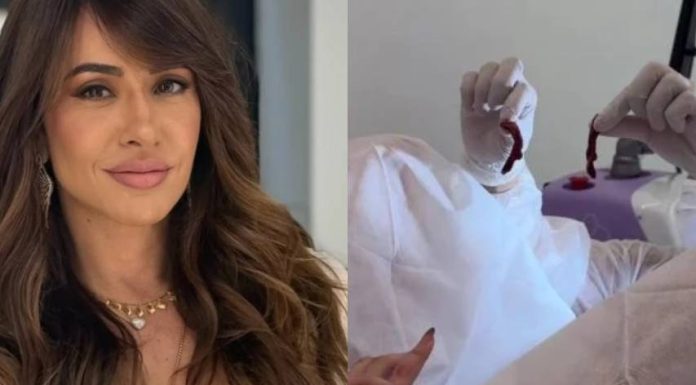 Infuencer retira excesso de lábios vaginais e mostra foto do resultado