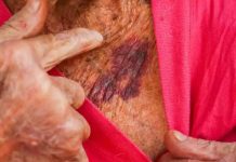 Mulher é presa por maus-tratos contra a própria mãe idosa em Itajaí