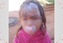 Criança de 3 anos leva 27 pontos no rosto após ser atacada pór cachorro
