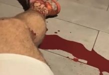 Homem sofre hemorragia na perna e sangra até a morte em Penha