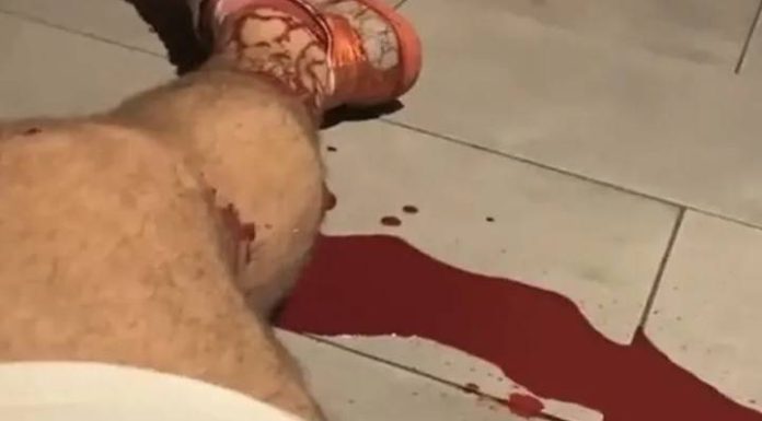 Homem sofre hemorragia na perna e sangra até a morte em Penha