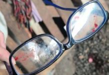 Idoso de 81 anos é ferido com golpes de facão durante roubo em SC