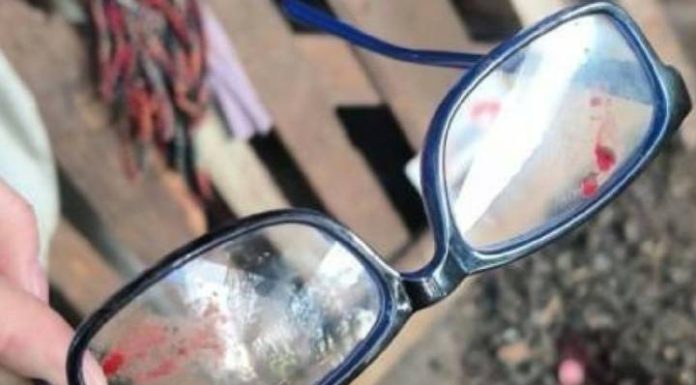 Idoso de 81 anos é ferido com golpes de facão durante roubo em SC