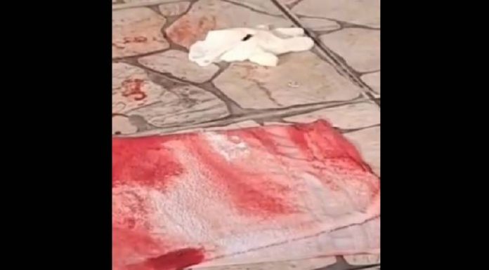 VIDEO Homem leva facada no pescoço durante briga no bailão em Barra Velha