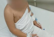 Menina tem a mão queimada pela madrasta no bairro Cordeiros