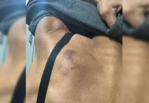 Casal joga pimenta na vagina de mulher e ameaça: “Vou te degolar”