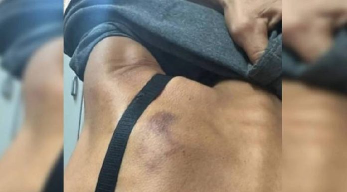 Casal joga pimenta na vagina de mulher e ameaça: “Vou te degolar”