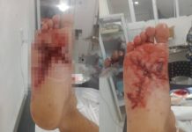 Foguete atinge pé de morador em Penha