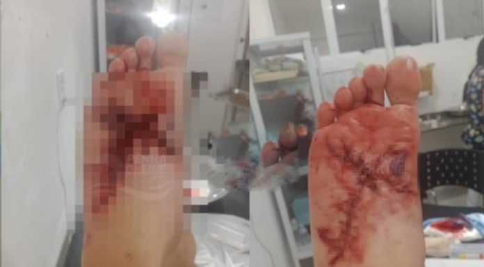 Foguete atinge pé de morador em Penha