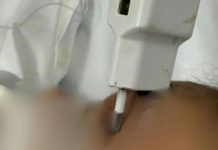 Criança cai da cama e fica com carregador cravado na testa