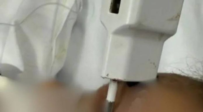Criança cai da cama e fica com carregador cravado na testa