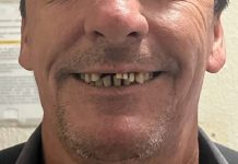 PIÇARRAS Campanha solidária busca realizar o sonho do “Seu Amadeu” de ter um novo sorriso