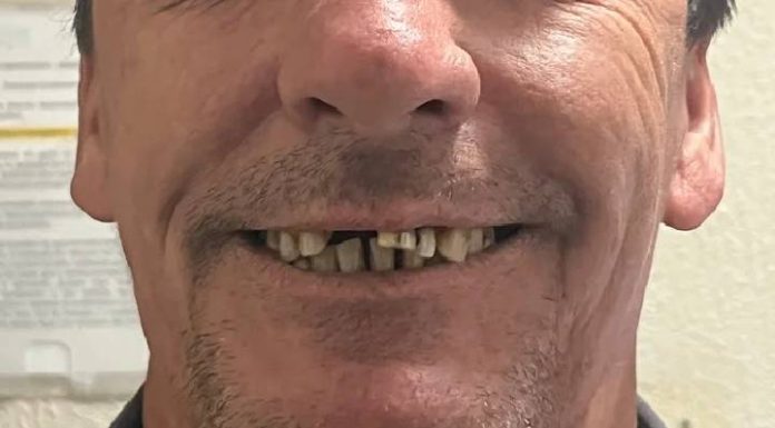 PIÇARRAS Campanha solidária busca realizar o sonho do “Seu Amadeu” de ter um novo sorriso