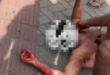 Homem é esfaqueado várias vezes em tentativa de homicídio em Navegantes