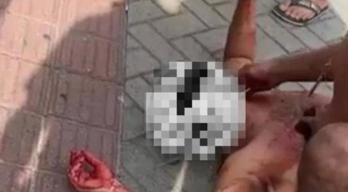 Homem é esfaqueado várias vezes em tentativa de homicídio em Navegantes