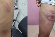 Menino autista é espancado por mãe de aluno
