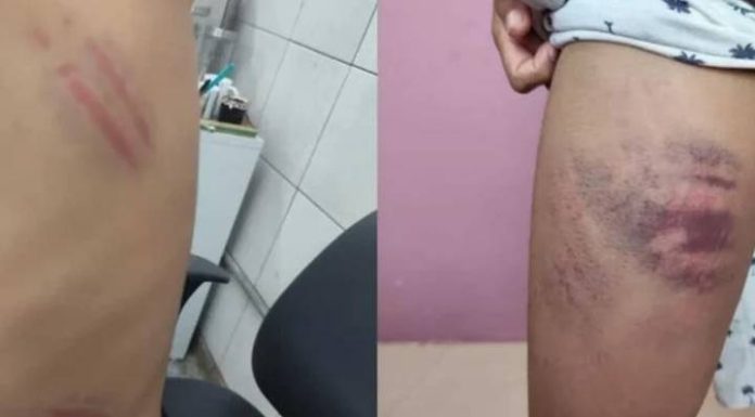 Menino autista é espancado por mãe de aluno