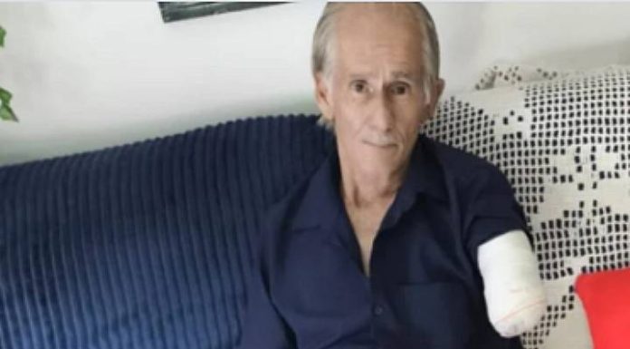 IDOSO ATACADO POR PITBULLS PERDE BRAÇO E TENTA RECOMEÇAR: “ELE NÃO LEMBRA DE NADA”