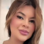 MULHER QUE TEVE AS MÃOS AMPUTADAS A GOLPES DE FOICE TEVE OS MEMBROS REIMPLANTADOS, DIZ DELEGADO