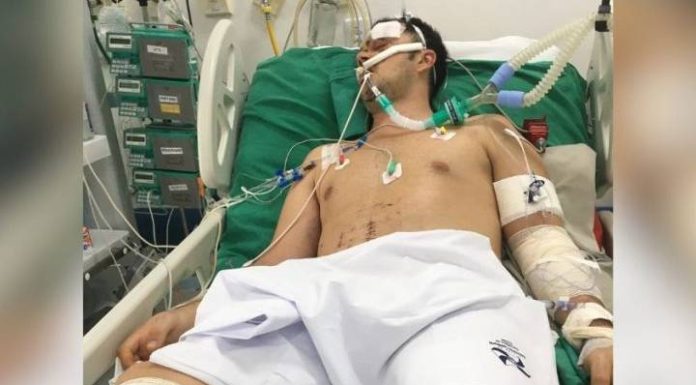 SOBREVIVENTE DE ATROPELAMENTO EM ITAPEMA LUTA PARA VOLTAR A ANDAR COM PRÓTESE DE ALTA TECNOLOGIA