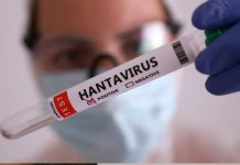 Homem de 46 anos é a primeira vitima morta por hantavírus no Brasil