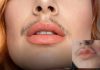 Bigode feminino vira tendência e desafia padrões de beleza nas redes sociais